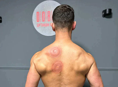 SmartCup Therapy Device